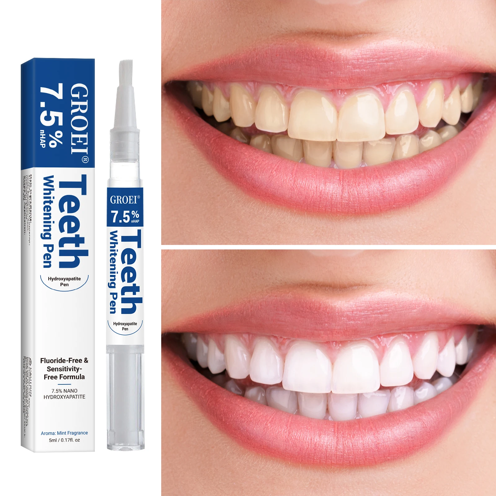 Hydroxyapatite Tooth Whitening - đánh giá và giá Teeth Whitening Gels Used By Dentists