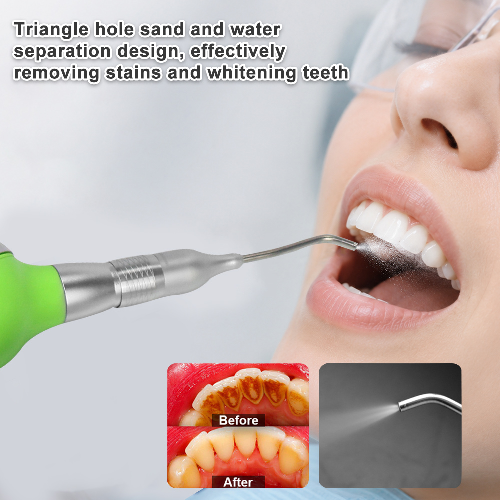 Dental Air Polisher With Anti- - đánh giá và giá Teeth Whitening Options