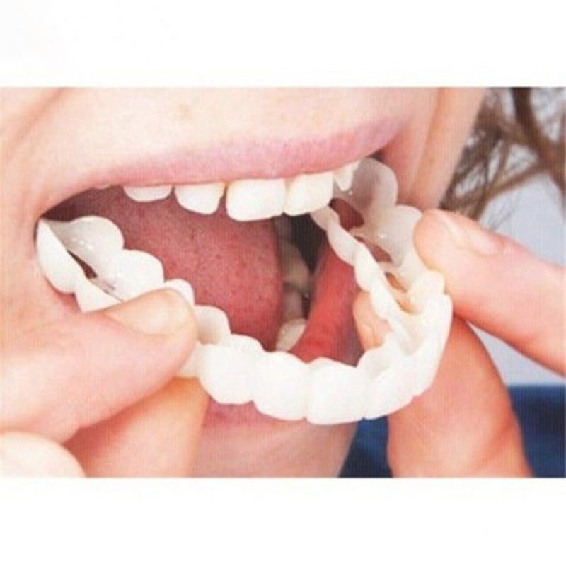 1 Nha Khoa Trên Và Giả Răng Ba - đánh giá và giá Teeth Whitening Veneers