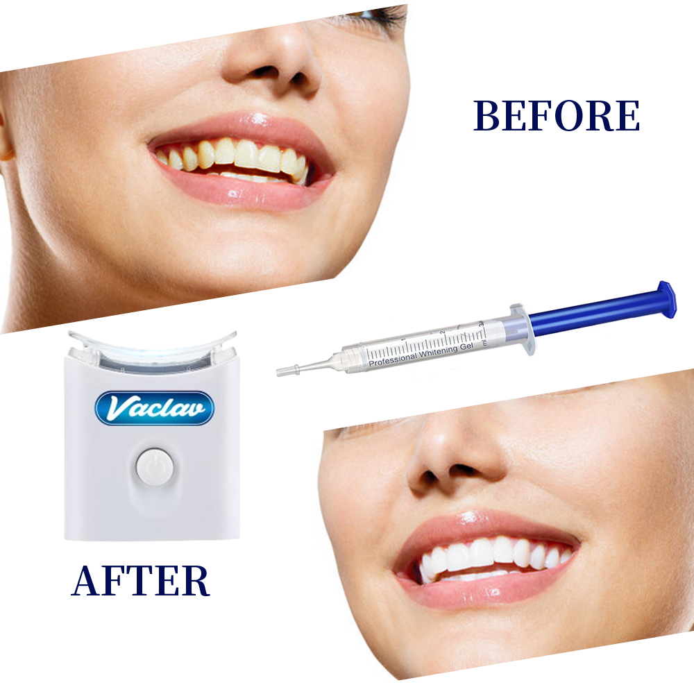 Mint Teeth Whitening Gel Syrin - đánh giá và giá Teeth Whitening Kit At Home