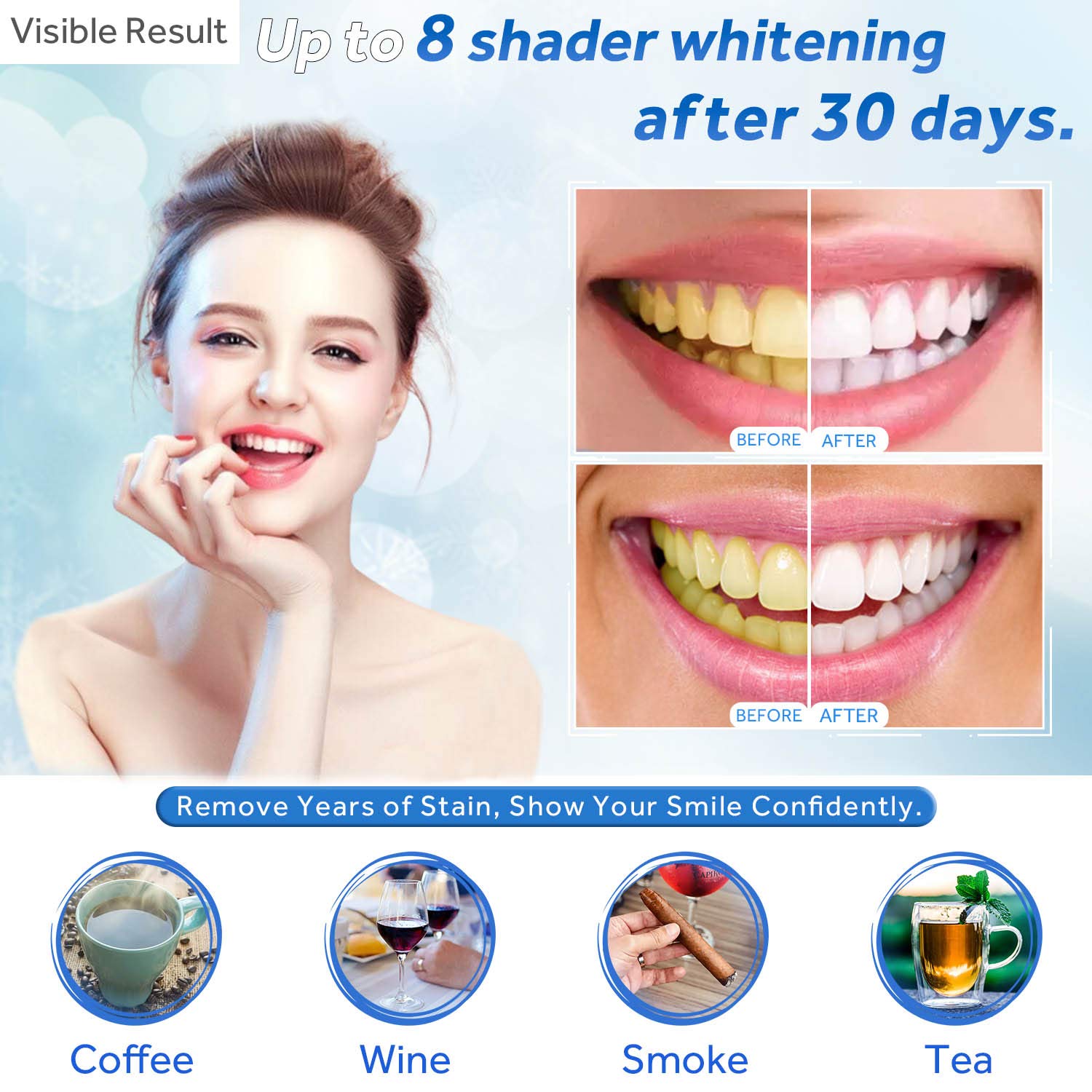 Teeth Whitening Gel Refill Syr - đánh giá và giá Teeth Whitening Gels Used By Dentists