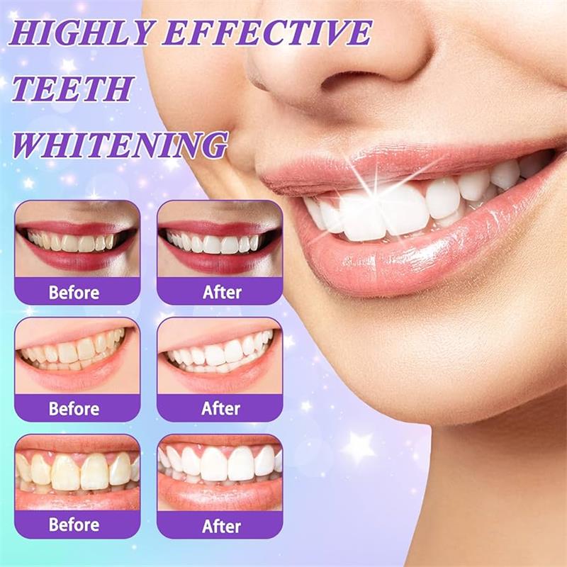 9D Purple Teeth Whitening Toot - đánh giá và giá Remineralizing Toothpaste
