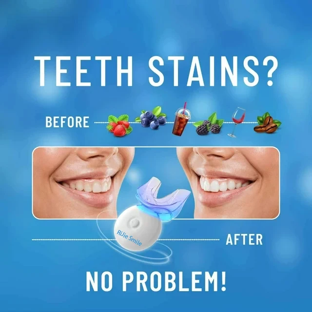 High Quality Cleaning Kit Wire - đánh giá và giá Teeth Whitening Kit At Home
