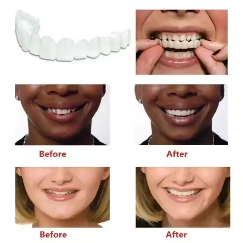 Teeth Veneers Whitening Dentur - đánh giá và giá Teeth Whitening Veneers