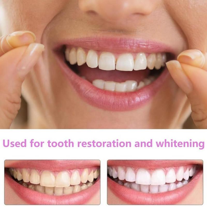 Snap On Teeth Veneers Instant  - đánh giá và giá Teeth Whitening Veneers