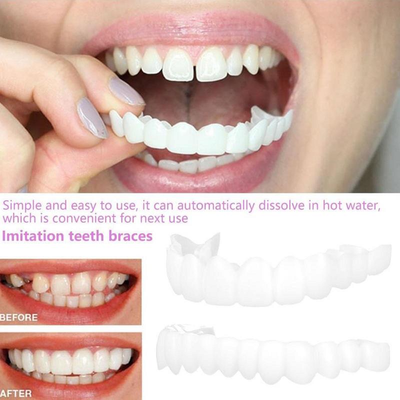 Snap On Teeth Veneers Instant  - đánh giá và giá Teeth Whitening Veneers