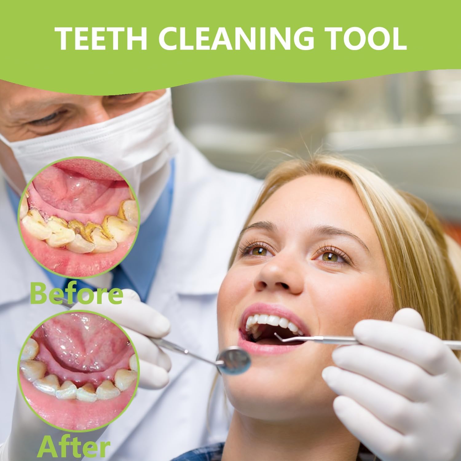 Professional Teeth Cleaning Or - đánh giá và giá Teeth Whitening Mouthwash