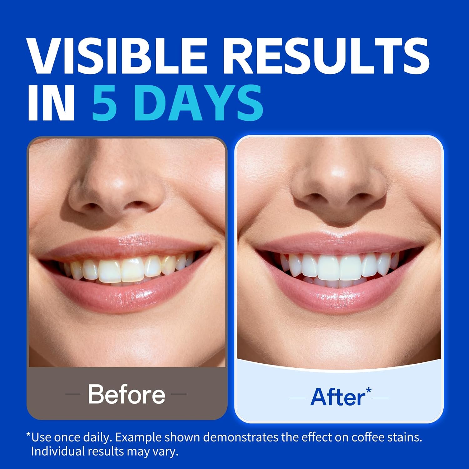 1/7 pairs Teeth Whitening Stri - đánh giá và giá Teeth Whitening Strips Crest