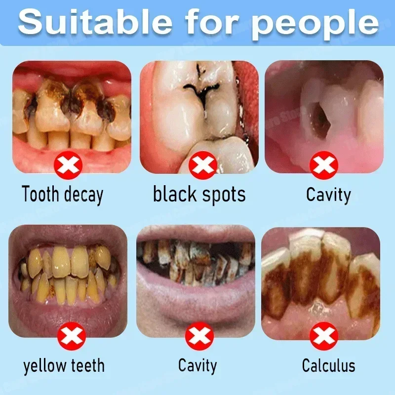 Anti Decay Toothpaste Repairs  - đánh giá và giá Remineralizing Toothpaste