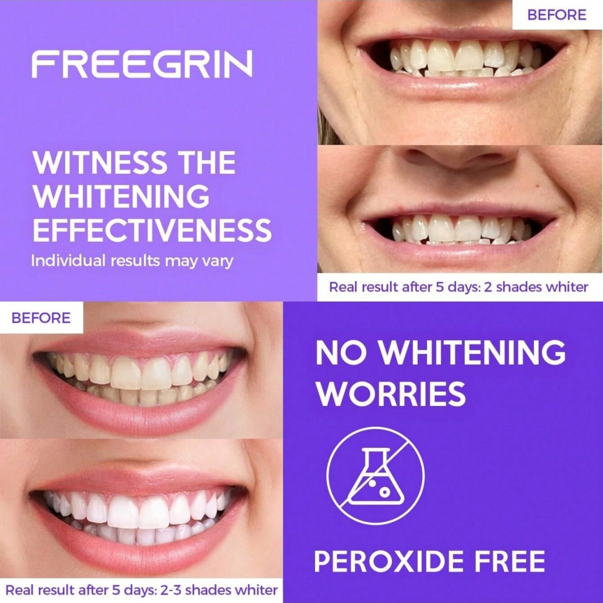 Deluxe Whitening Teeth Sticker - đánh giá và giá Teeth Whitening Gels Used By Dentists