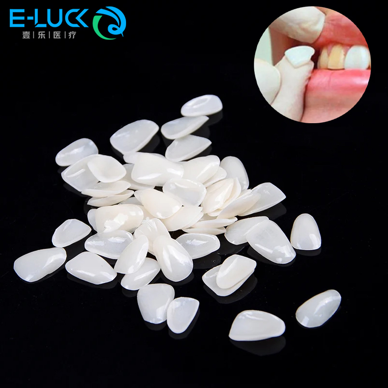 50pcs Dental Teeth Veneers Tem - đánh giá và giá Teeth Whitening Veneers