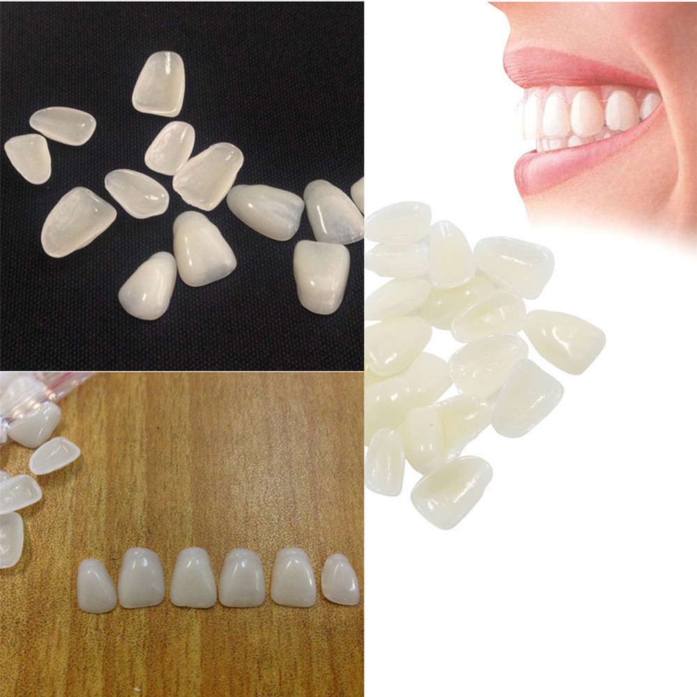 70PCS/Package Beauty Veneers W - đánh giá và giá Teeth Whitening Veneers