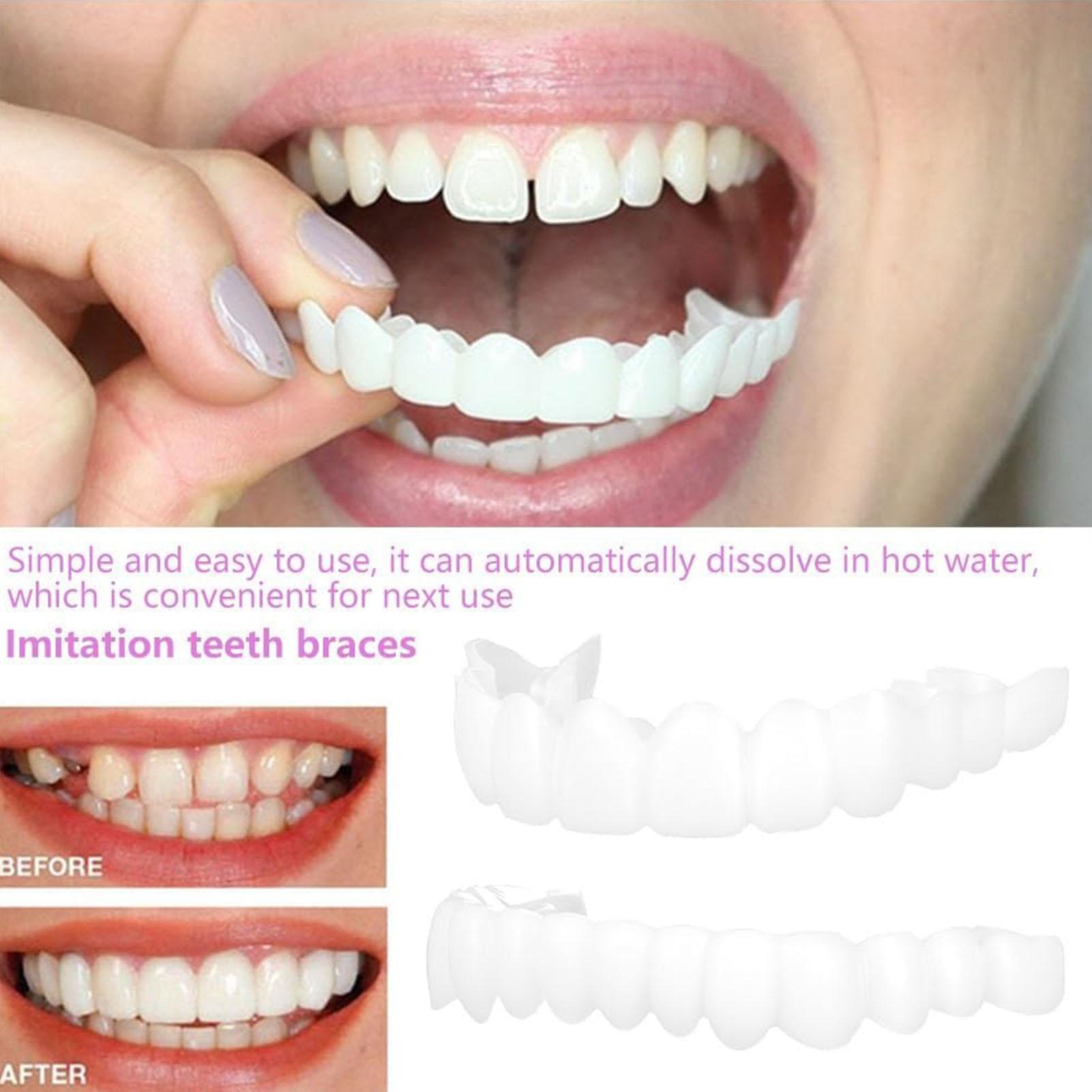 2pcs Men Women Temporary Teeth - đánh giá và giá Teeth Whitening Veneers