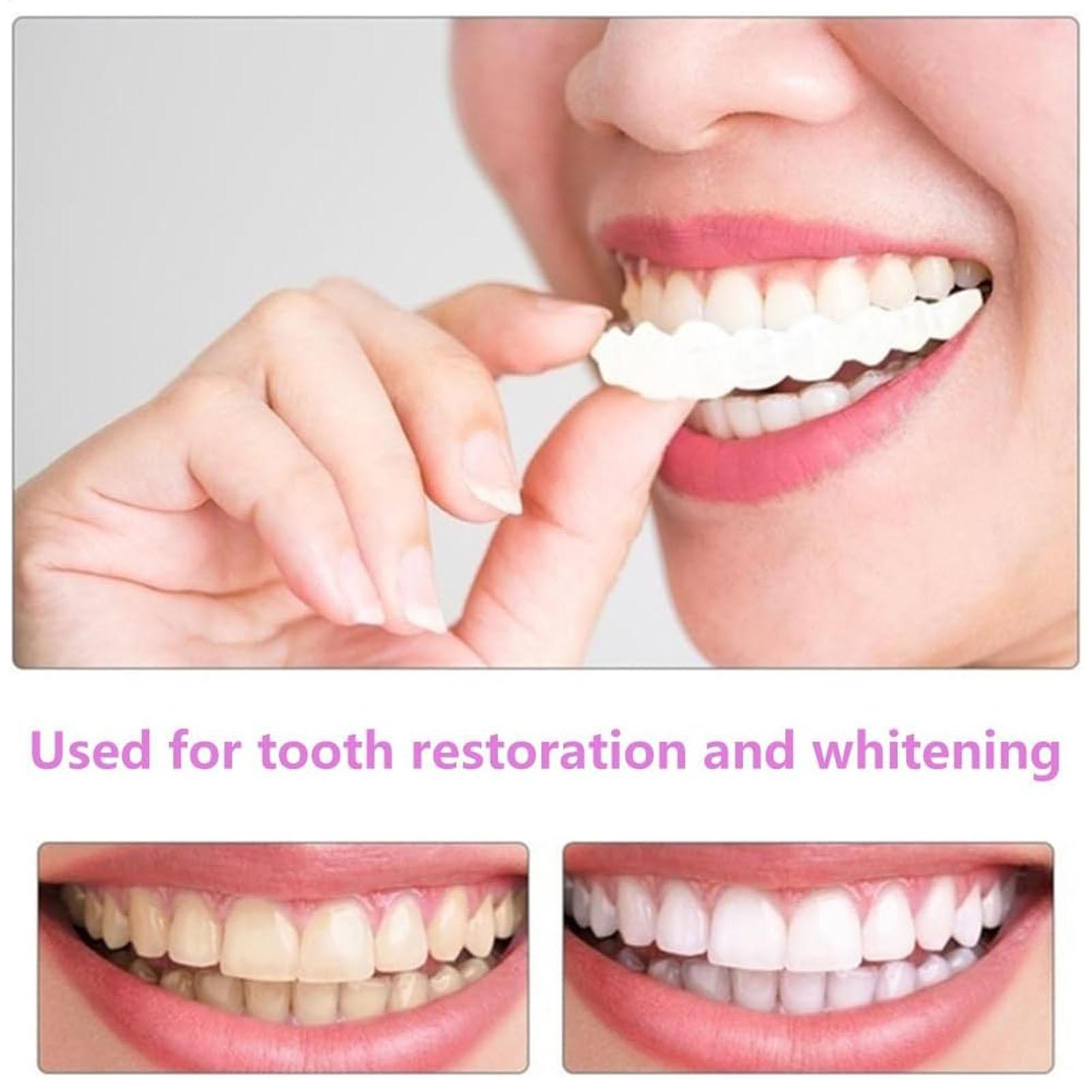 2pcs Men Women Temporary Teeth - đánh giá và giá Teeth Whitening Veneers