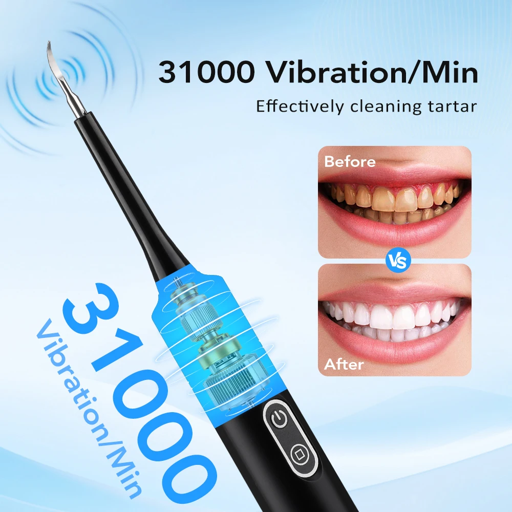 Electric Sonic Vibration Denta - đánh giá và giá Teeth Whitening Mouthwash
